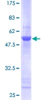 Human TSN / Translin Protein (Recombinant GST)