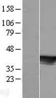 C6orf81 Protein (Over-Expression Lysate Myc-DDK (Flag))
