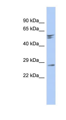 Polyclonal Rabbit anti-Human RD3 Antibody (aa35-84, WB)