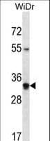 OR2W5 Antibody (aa283-311)