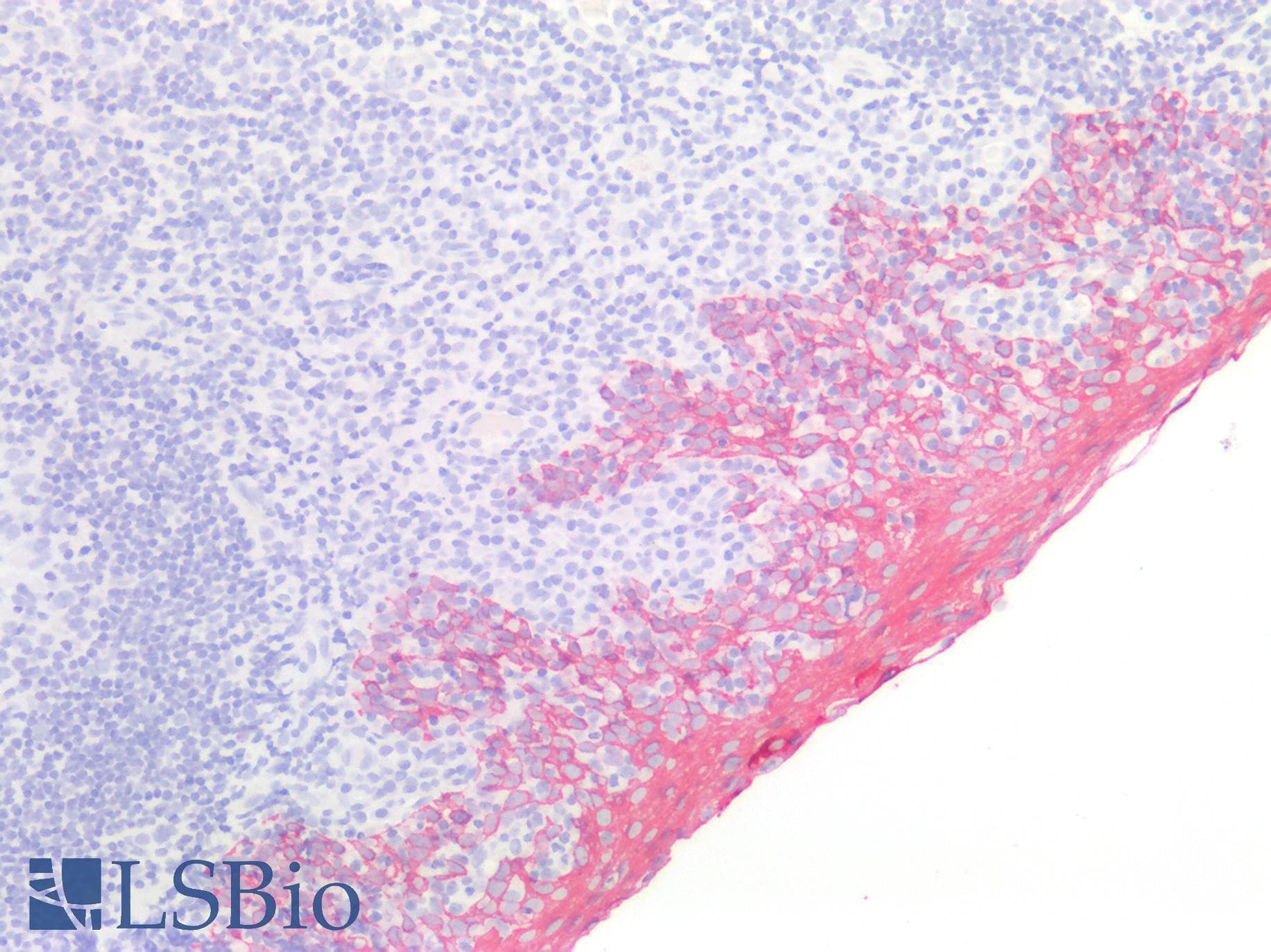 PathPlus™ Basic Cytokeratin AE3 Antibody (clone AE3)
