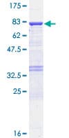 Human UGDH / UDPGDH Protein (Recombinant GST)