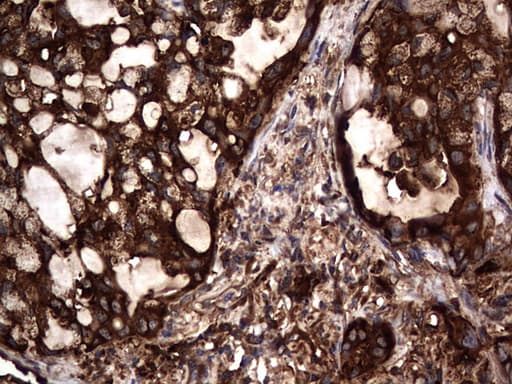 CEACAM5 / CD66e Antibody (aa35-680, clone OTI1C2)