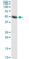 RORC / ROR Gamma Antibody (clone 1G7)