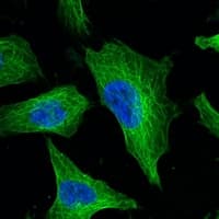 TUBB3 / Tubulin Beta 3 Antibody