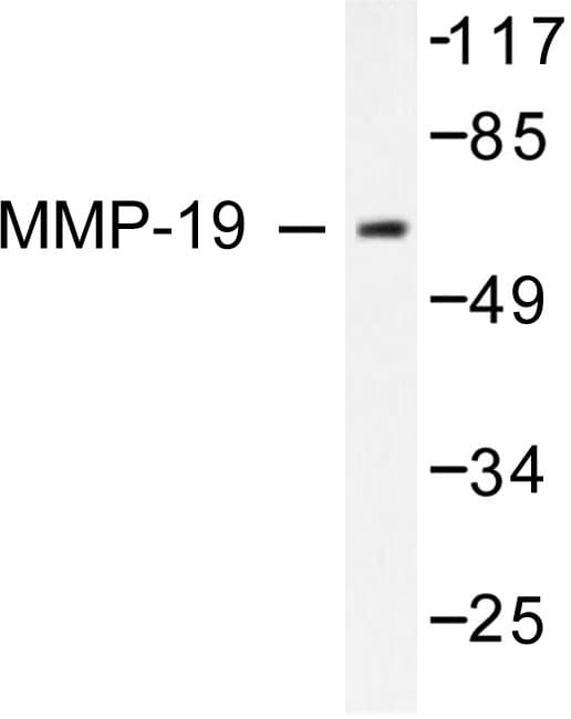 MMP19 Antibody (Gly44)