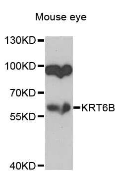 KRT6B / CK6B / Cytokeratin 6B Antibody