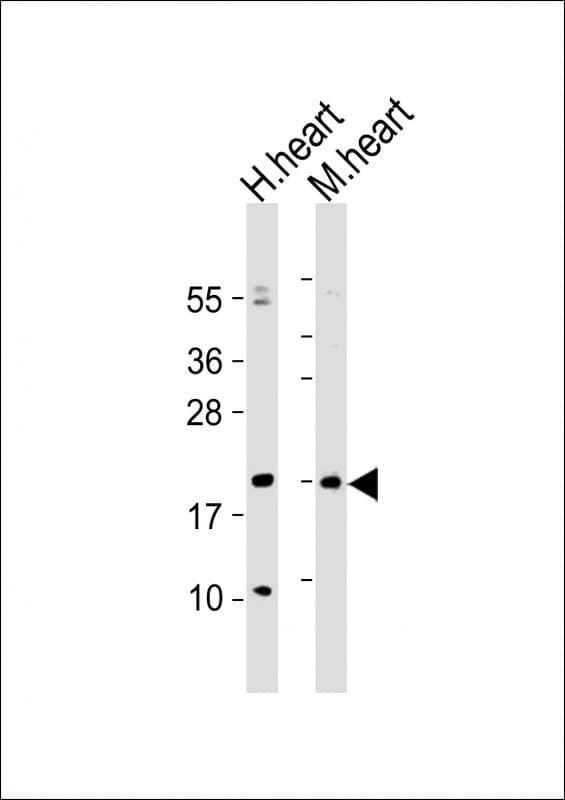 HOPX / HOP Antibody (aa22-54)