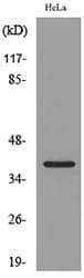CXCR6 Antibody