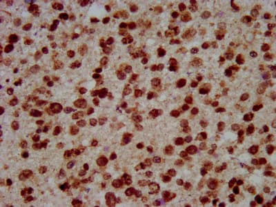 Polyclonal Rabbit anti-Human HIST1H3A Antibody (IHC, IF, WB)