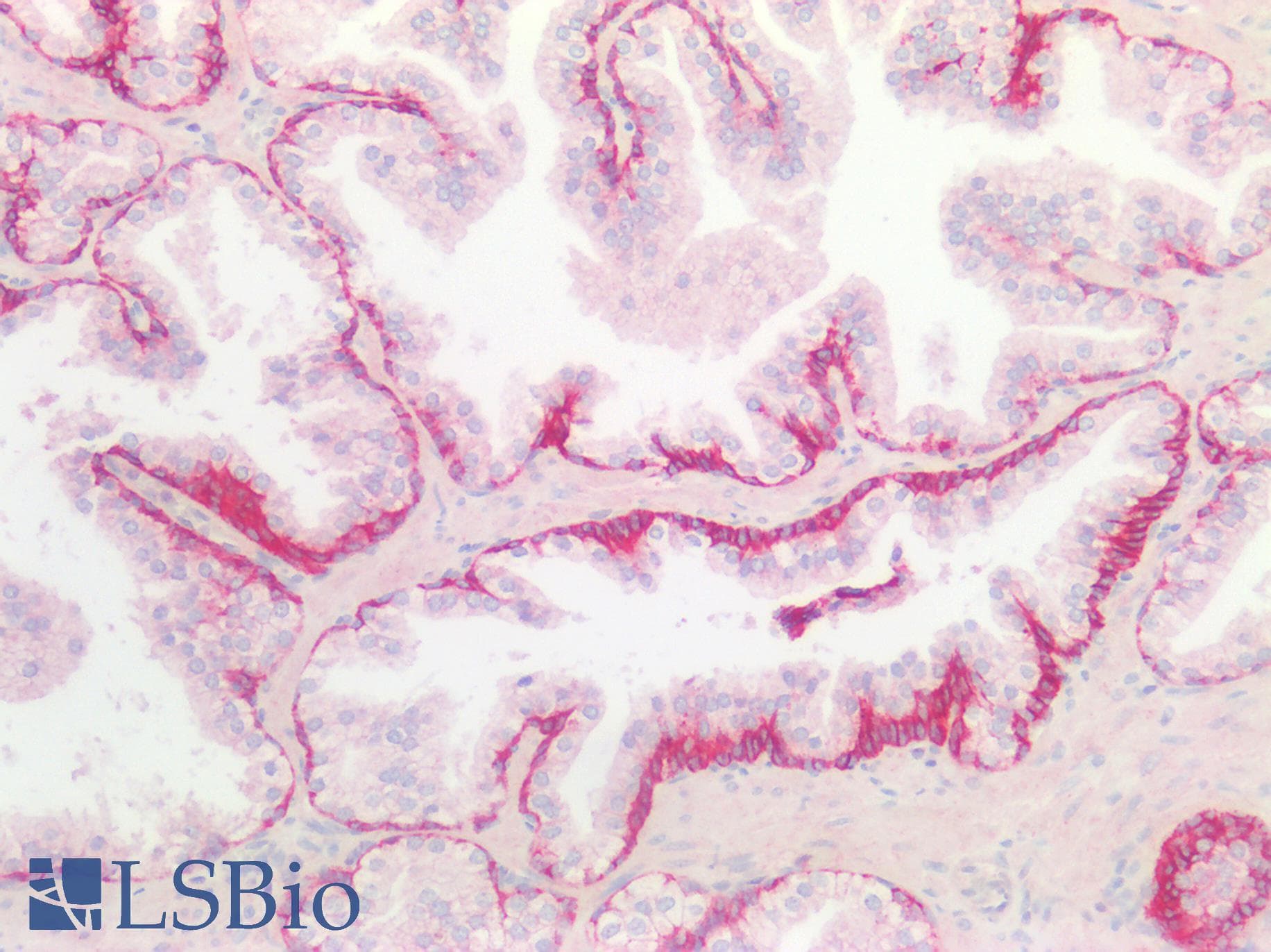 IHC-plus™ SDC1 / Syndecan 1 / CD138 Antibody (aa25-240)