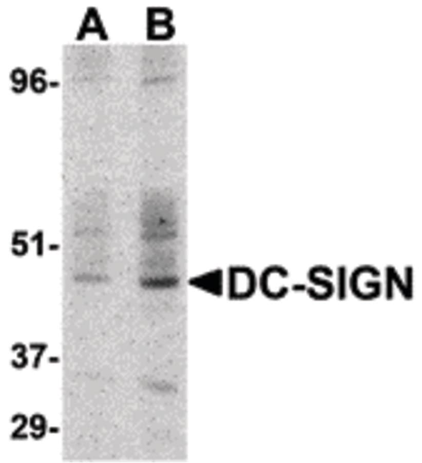 IHC-plus™ CD209 / DC-SIGN Antibody