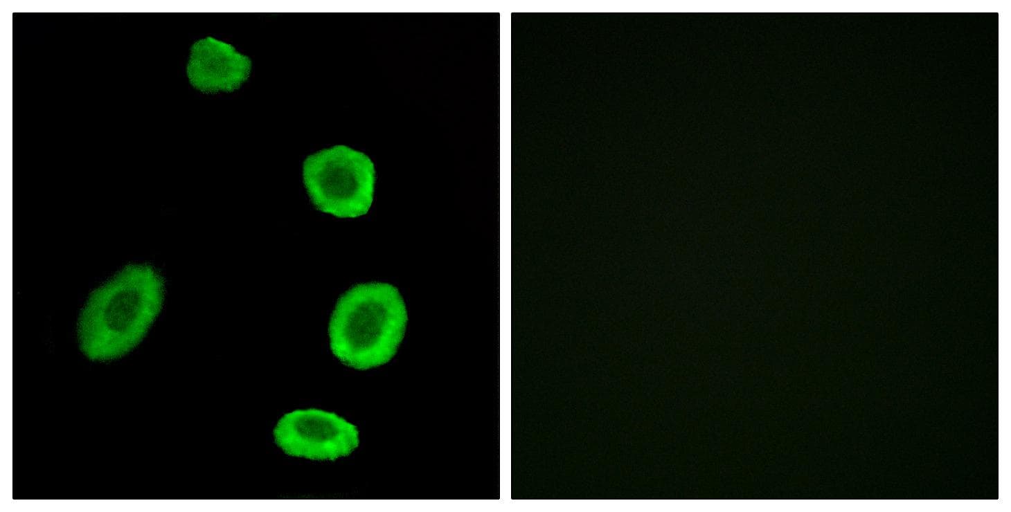OR8K1 Antibody