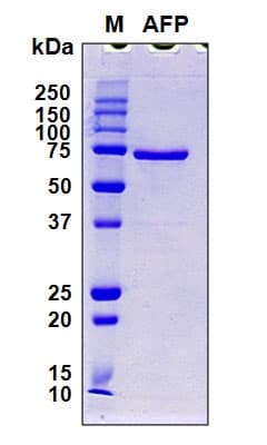Human Alpha-Fetoprotein (Recombinant 6His, N-terminus)