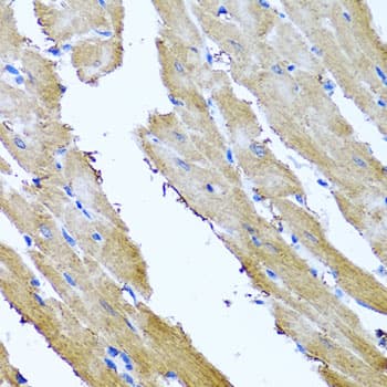SRI / Sorcin Antibody