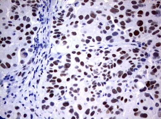 FOXP1 Antibody (clone UMAB89)