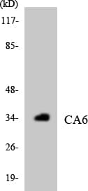 CA6 / Carbonic Anhydrase 6 Antibody (aa221-270)