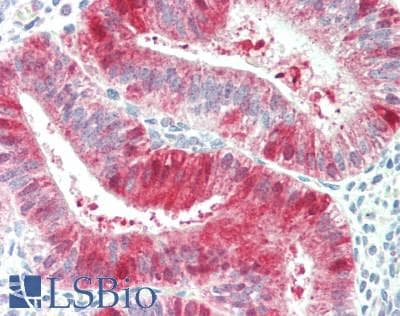 Polyclonal Rabbit anti-Human SERPINB9 / PI9 Antibody (aa122-150, IHC, WB)