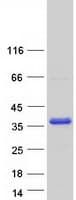 Human MAST4 Protein (Recombinant Myc-DDK (Flag))
