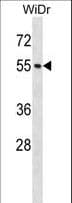 Polyclonal Rabbit anti-Human NUP50 Antibody (aa224-252, WB)