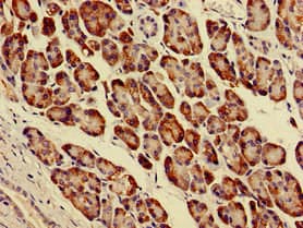 Polyclonal Rabbit anti-Human PARVA Antibody (IHC, IF, WB)