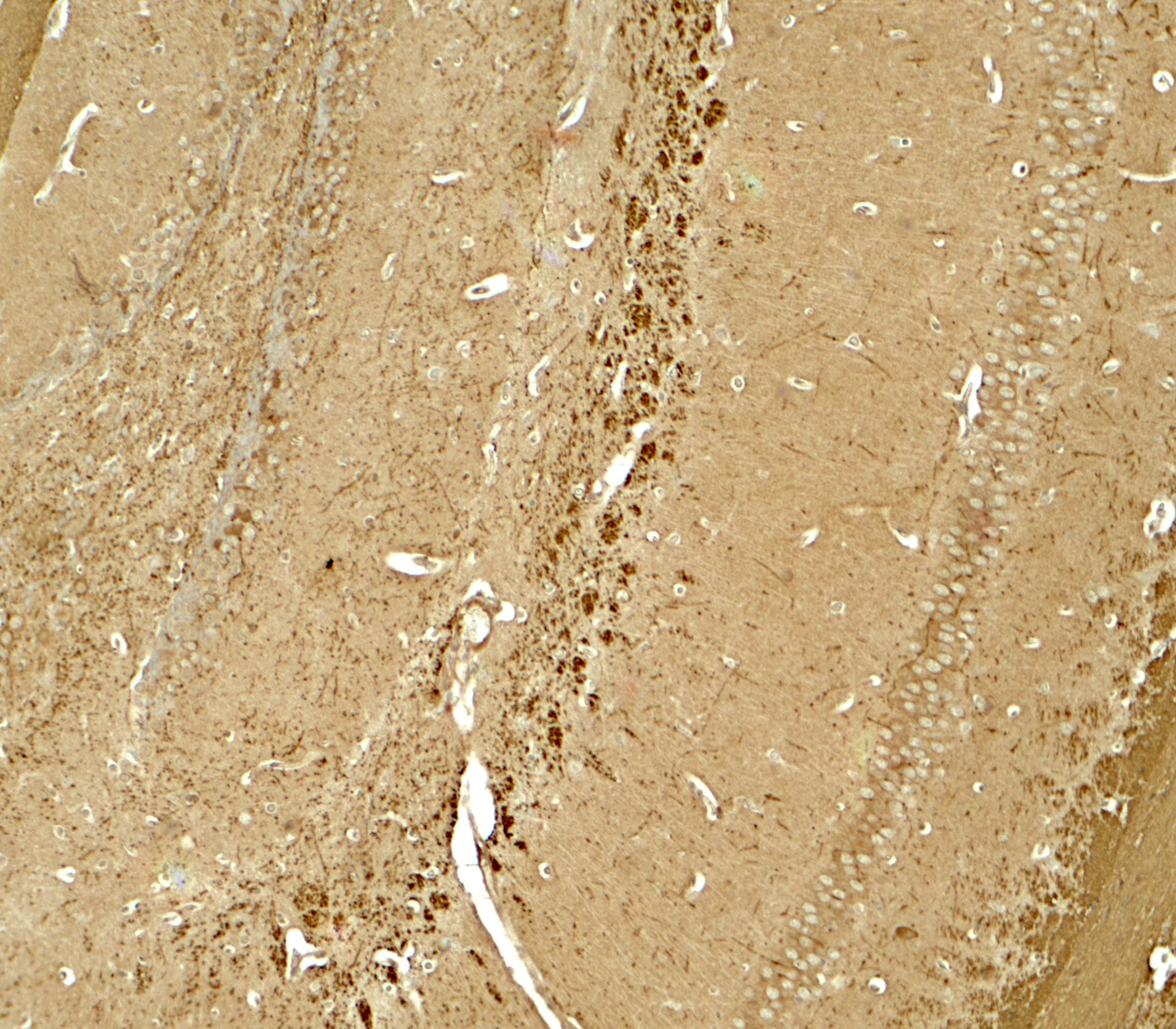 IHC-plus™ NINJ1 / Ninjurin Antibody