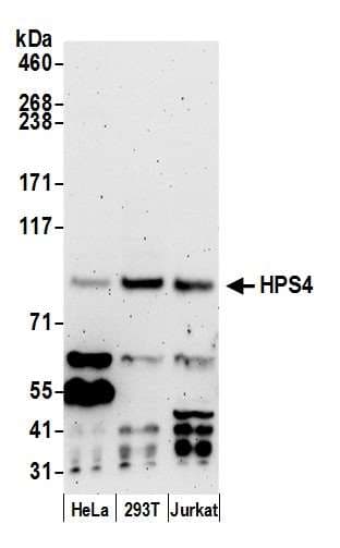 HPS4 Antibody (aa658-708)