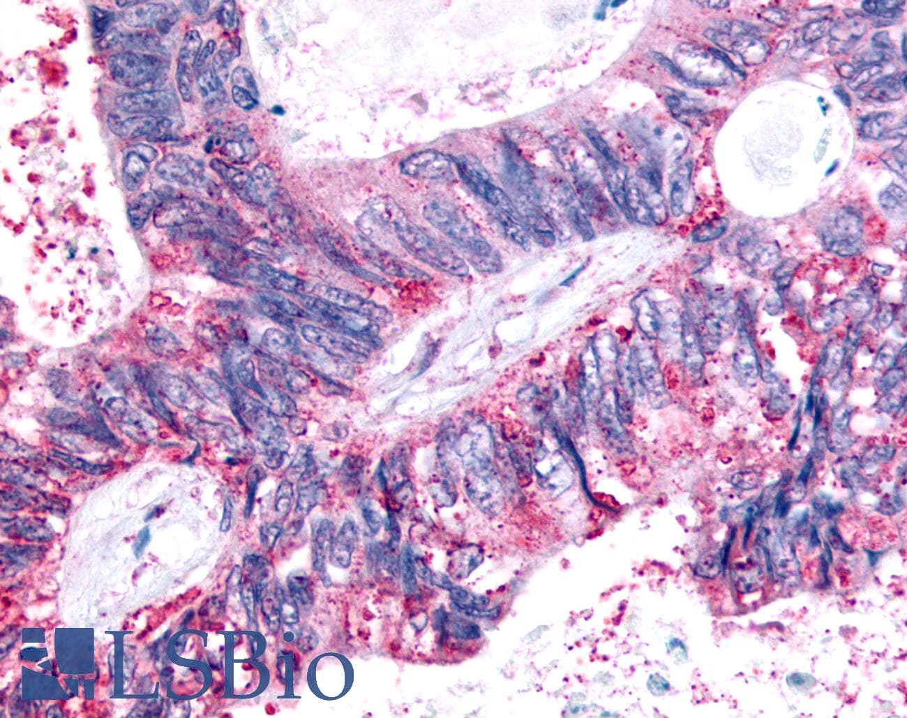 PathPlus™ FFAR2 / GPR43 Antibody (Extracellular Domain)
