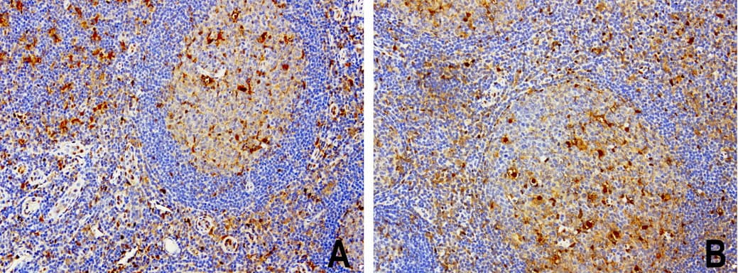 TP / Thymidine Phosphorylase Antibody (aa311-482, clone UMAB97)