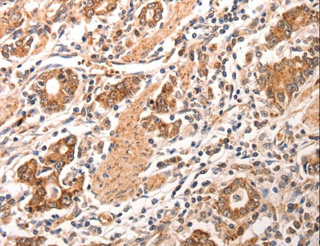 IHC-plus™ CCL17 / TARC Antibody