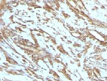 Muscle Actin Antibody (clone PMAC1-1, Ready-to-Use)