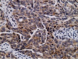 NT5DC1 Antibody (clone OTI1B1)