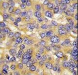Polyclonal Rabbit anti-Human DKK3 Antibody (aa15-45, IHC, WB)
