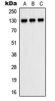 PECAM-1 / CD31 Antibody (Internal)