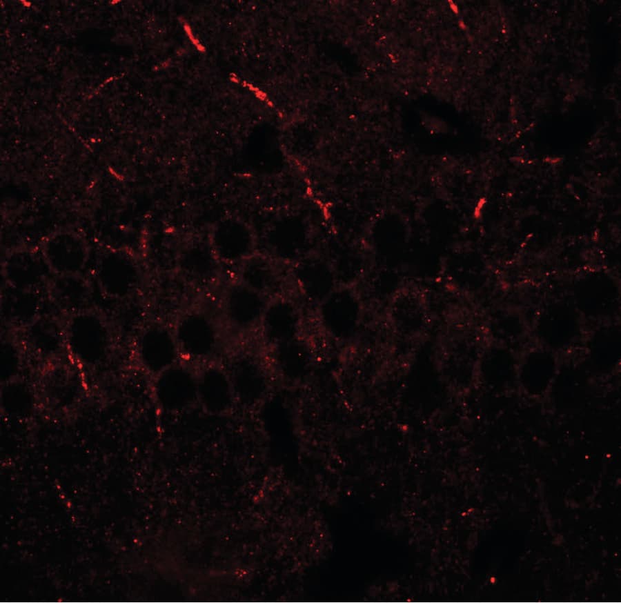 ARTS1 / ERAP1 Antibody