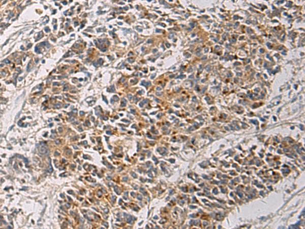 Polyclonal Rabbit anti-Human MAPKAPK3 Antibody (IHC)