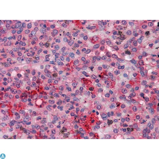 FGR Antibody