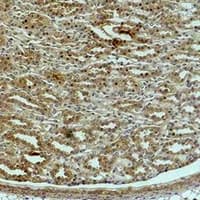 ACTN1 Antibody