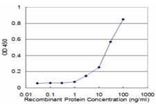 Monoclonal Mouse anti-Human PSMB10 Antibody (clone 3F8, IF, WB)