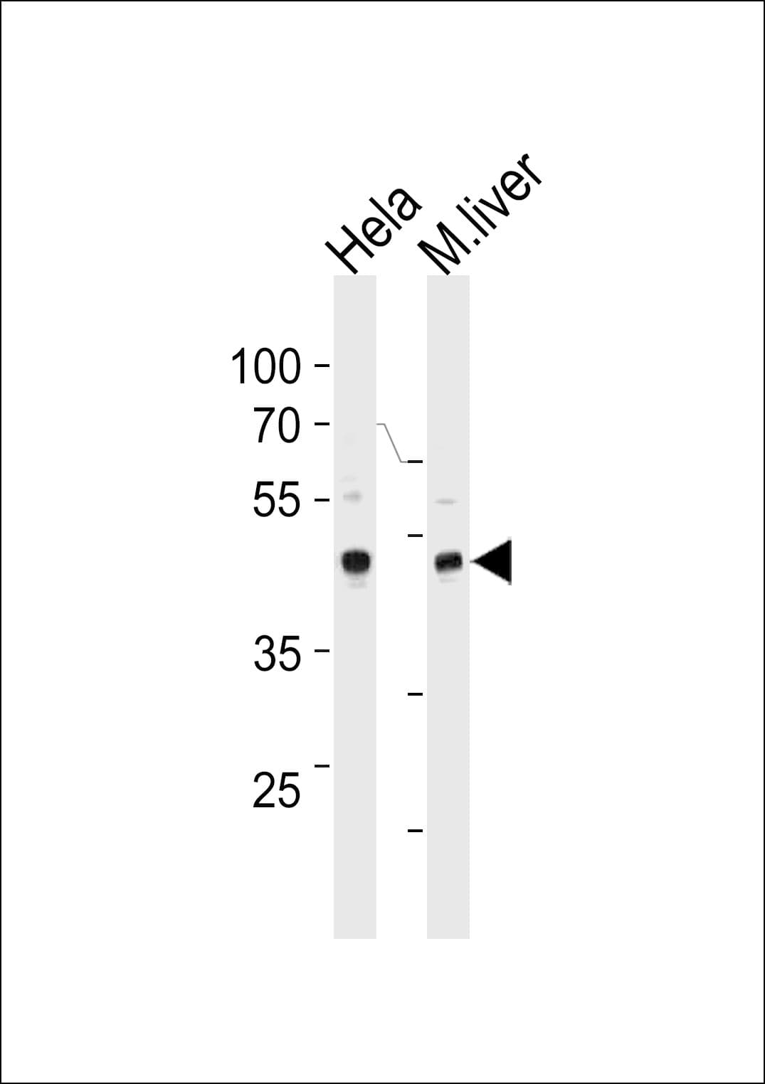 TBX6 Antibody (aa143-172)