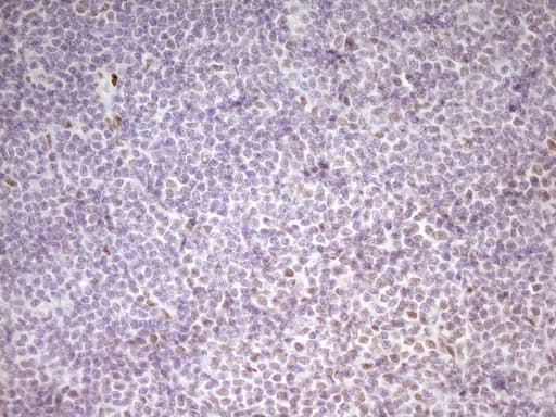 MEF2D Antibody (aa1-282, clone OTI1E11, Carrier-free)
