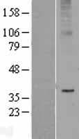 ADIPOR2 Protein (Over-Expression Lysate Myc-DDK (Flag))