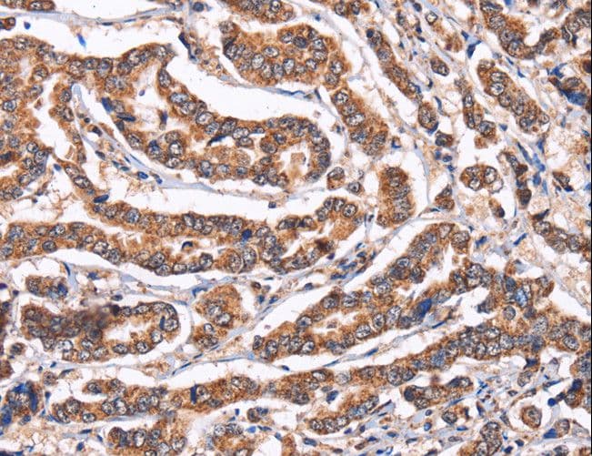 PPIF / Cyclophilin F Antibody