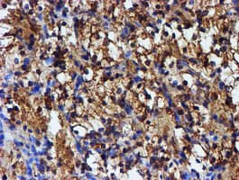 IDS / Iduronate 2 Sulfatase Antibody (clone OTI1D9)