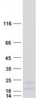 Human RNF122 Protein (Recombinant Myc-DDK (Flag))