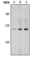 CD144 / CDH5 / VE Cadherin Antibody
