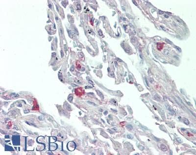 IHC-plus™ Monoclonal Mouse anti-Human IL8 / Interleukin 8 Antibody (IHC)