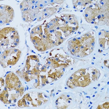 Polyclonal Rabbit anti-Human IMPA1 / IMP Antibody (IHC, IF, WB)
