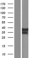 TBX6 Protein (Over-Expression Lysate Myc-DDK (Flag))