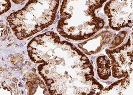 AQP1 / Aquaporin 1 Antibody